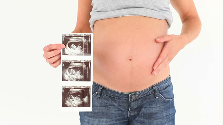 Pregnant woman holding ultrasound images.