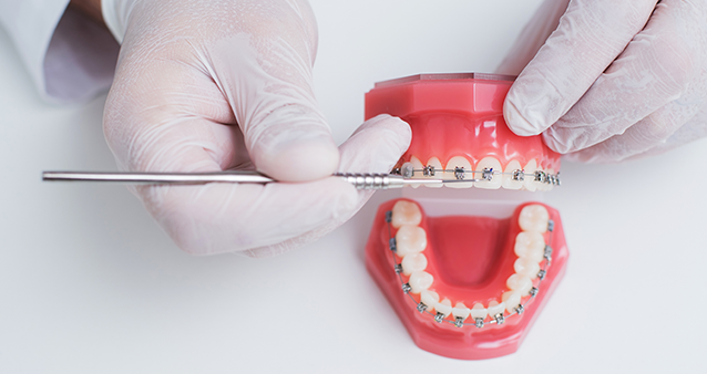 Braces being adjusted on dentures.