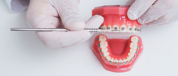 Does Medical Aid Cover Braces? Does Medical Aid Cover Braces?
