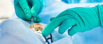 Laser Eye Surgery: Will your Medical Aid Cover it? Laser Eye Surgery: Will your Medical Aid Cover it?